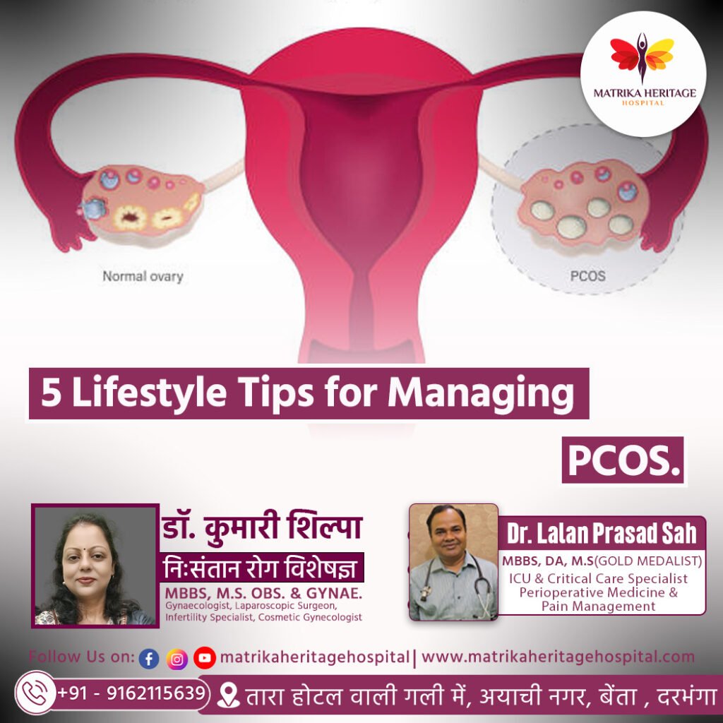 5 Lifestyle Tips for Managing PCOS.