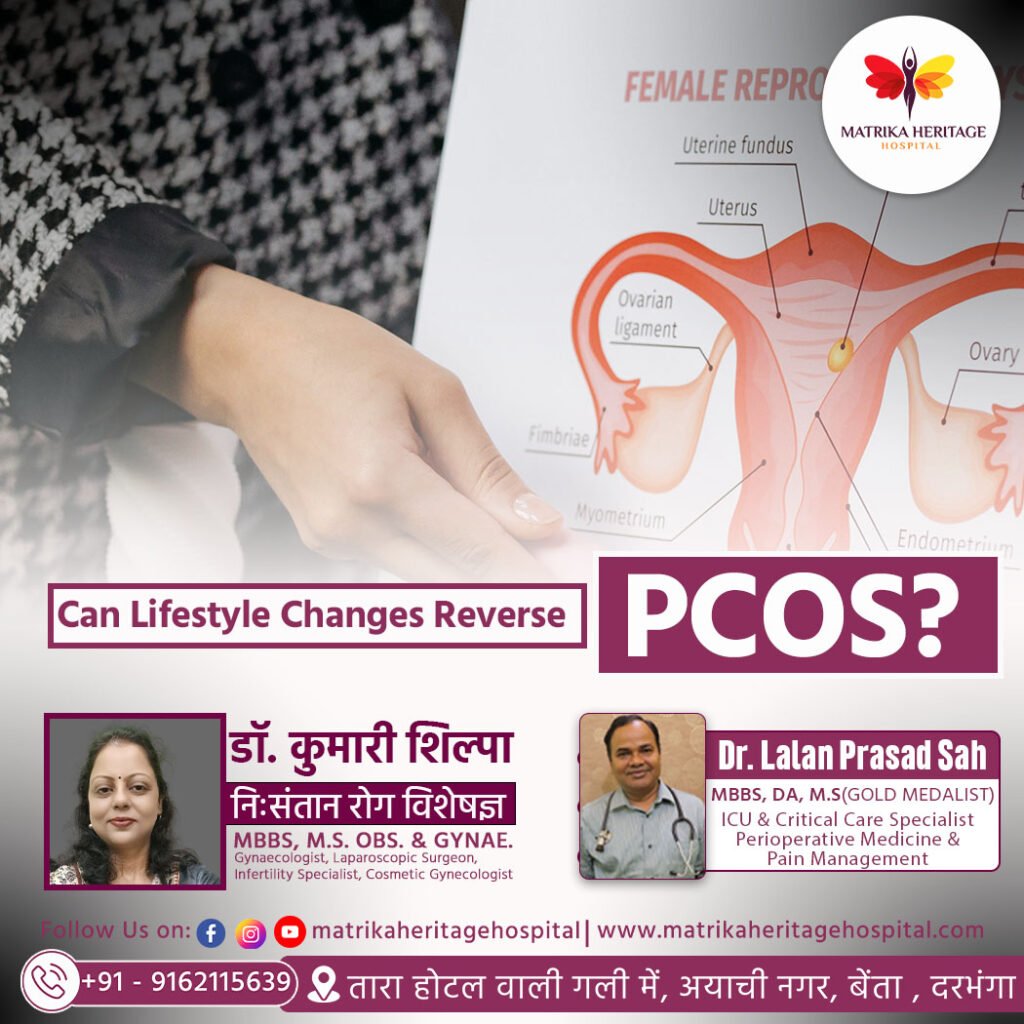 क्या लाइफस्टाइल चेंज से PCOS ठीक हो सकता है? जानिए एक्सपर्ट्स की राय