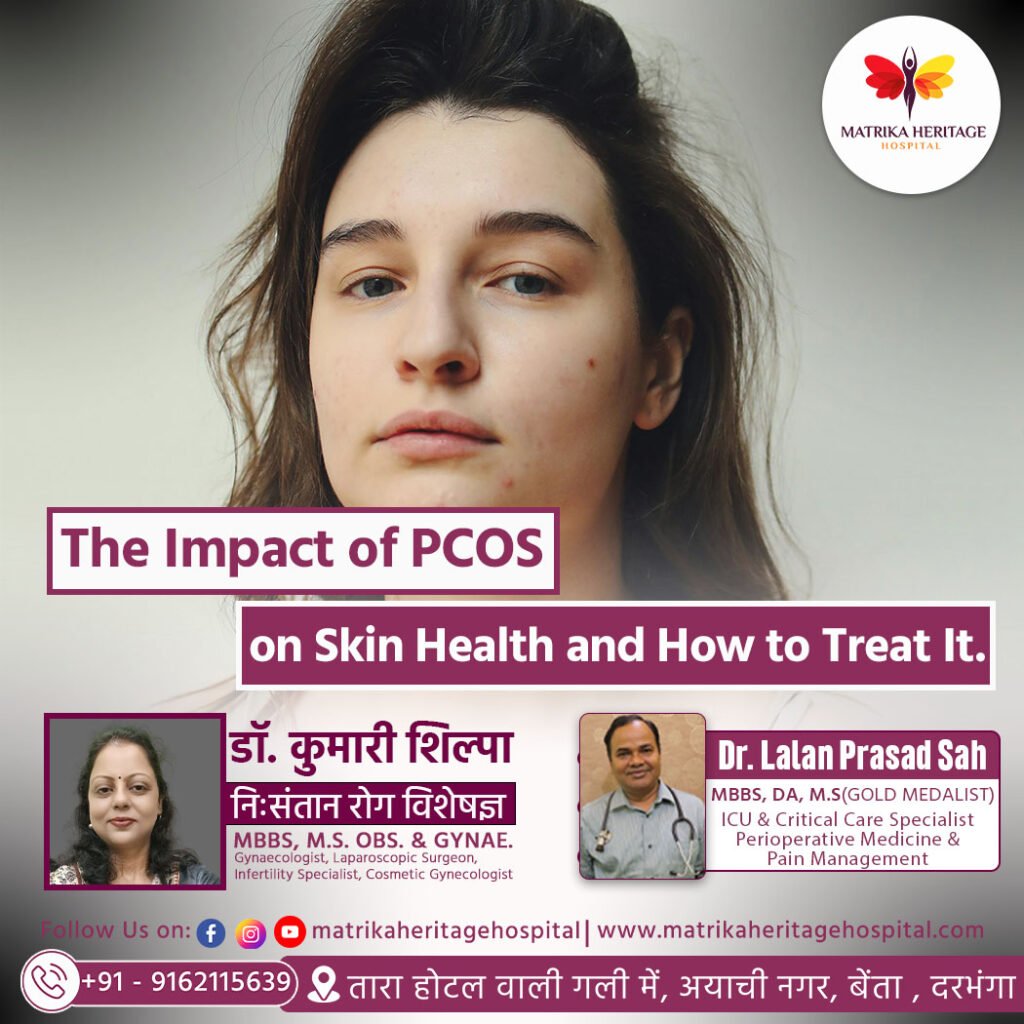 PCOS